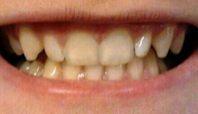 Esthetische tandheelkunde 1